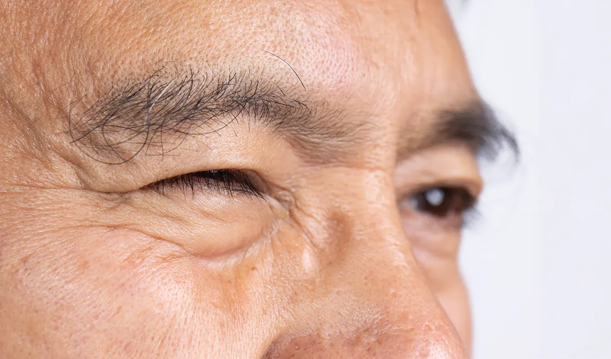 close-up of a man's eyes with one eye closed